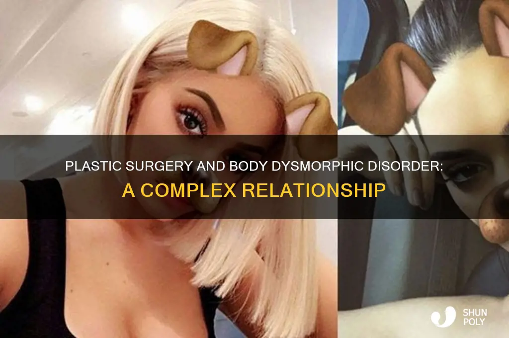 can plastic surgery ever solve body dysmorphic disorder