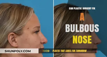 Can Plastic Surgery Reshape a Bulbous Nose? Expert Insights