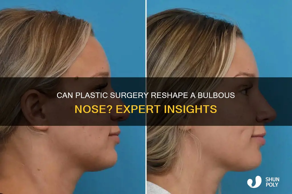 can plastic surgery fix a bulbous nose