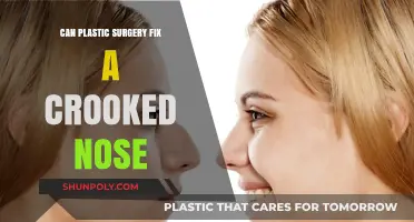 Can Plastic Surgery Correct a Crooked Nose? Expert Insights