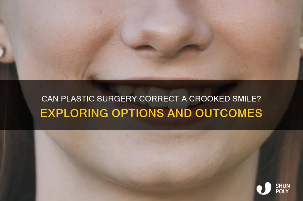 can plastic surgery fix a crooked smile