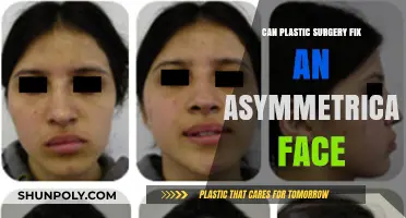 Can Plastic Surgery Correct Facial Asymmetry? Exploring Options and Outcomes