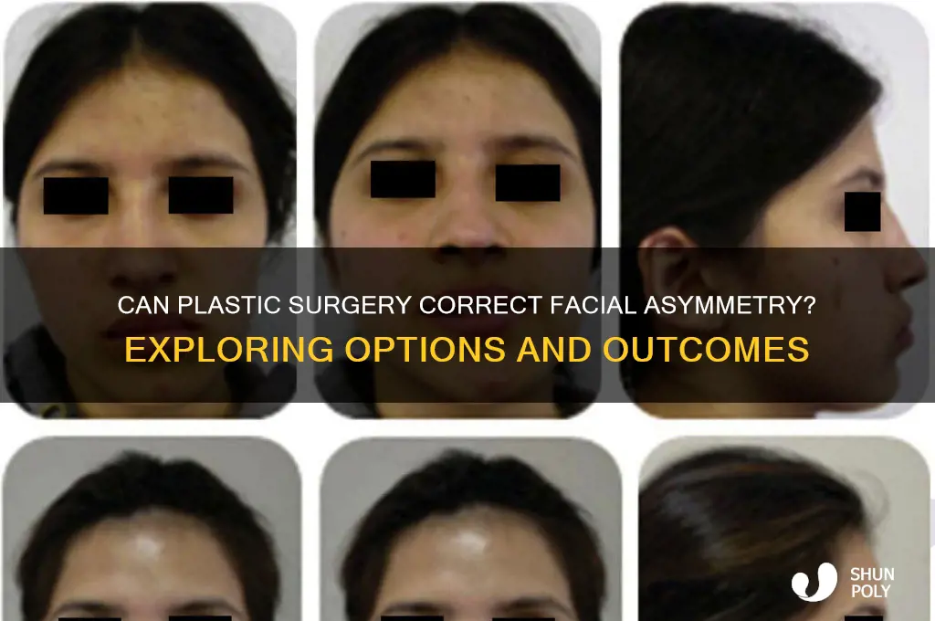 can plastic surgery fix an asymmetrical face