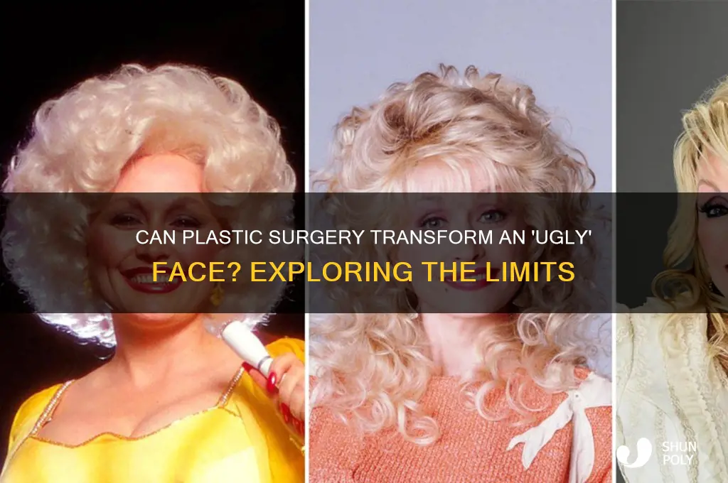 can plastic surgery fix an ugly face