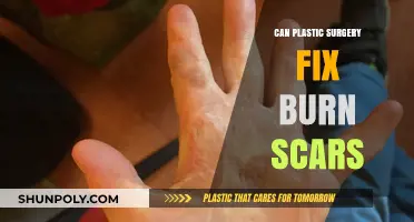 Can Plastic Surgery Effectively Treat Burn Scars? Expert Insights