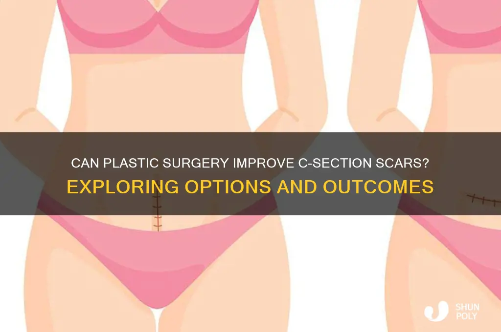 can plastic surgery fix c section scar