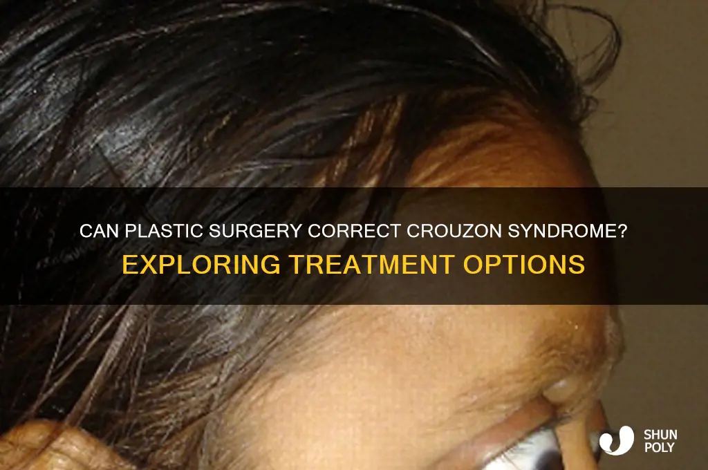 can plastic surgery fix crouzon syndrome