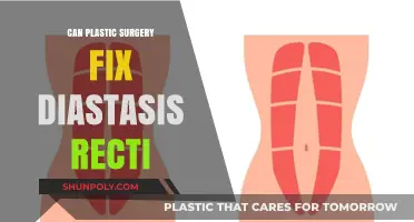 Can Plastic Surgery Effectively Repair Diastasis Recti? Expert Insights