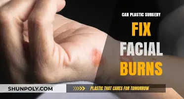 Can Plastic Surgery Repair Facial Burns? Exploring Options and Outcomes