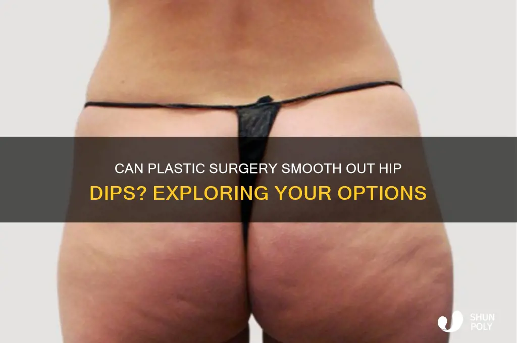 can plastic surgery fix hip dips
