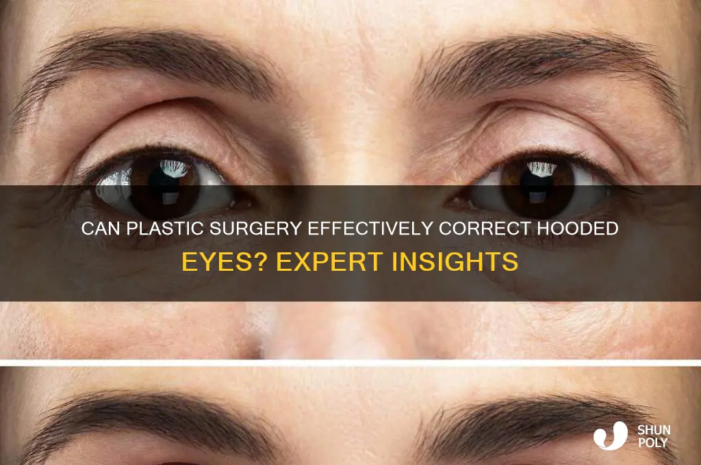 can plastic surgery fix hooded eyes