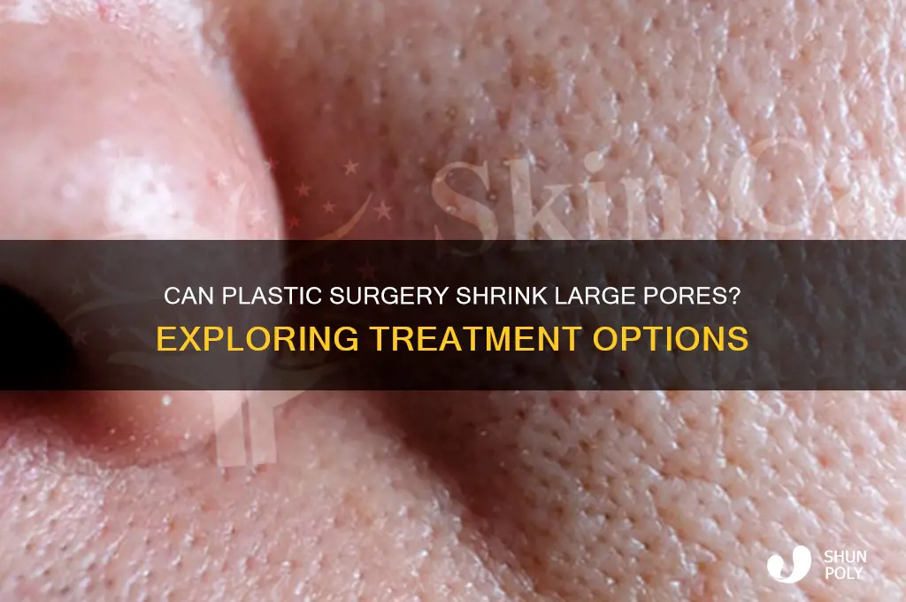 can plastic surgery fix large pores