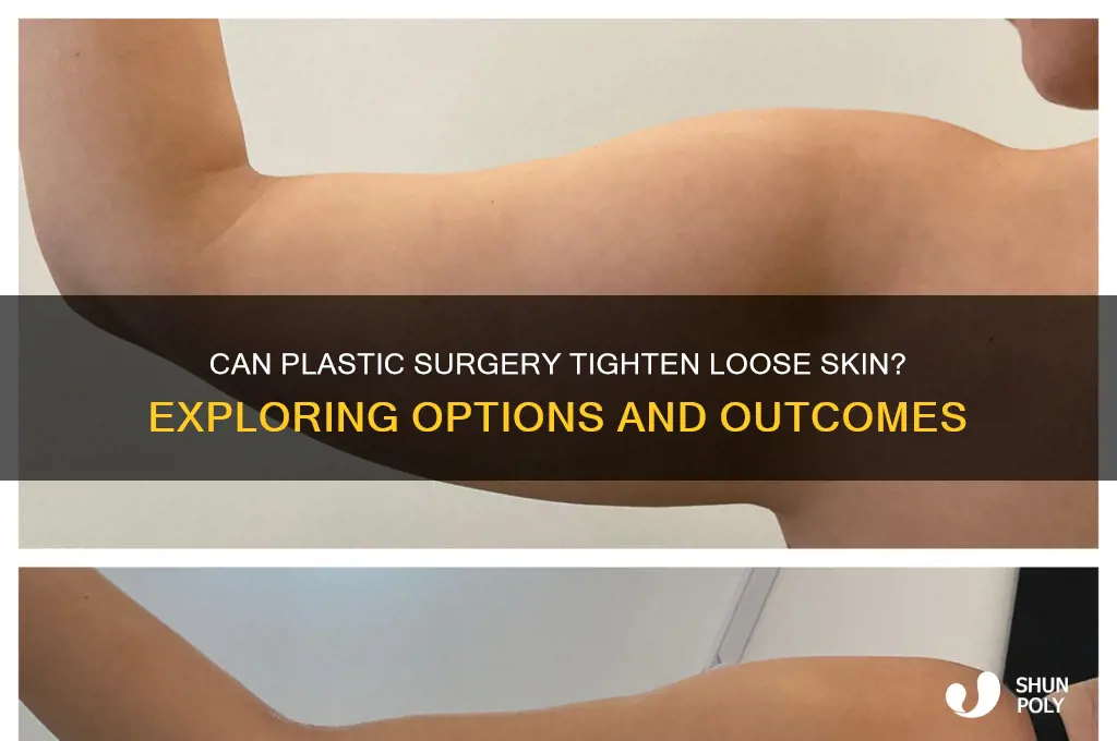 can plastic surgery fix looseness