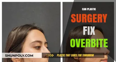 Can Plastic Surgery Correct an Overbite? Exploring Options and Limitations