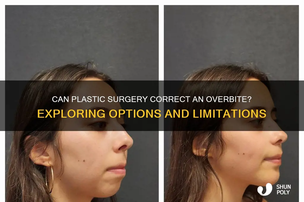 can plastic surgery fix overbite