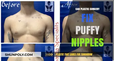 Can Plastic Surgery Correct Puffy Nipples? Exploring Options and Results