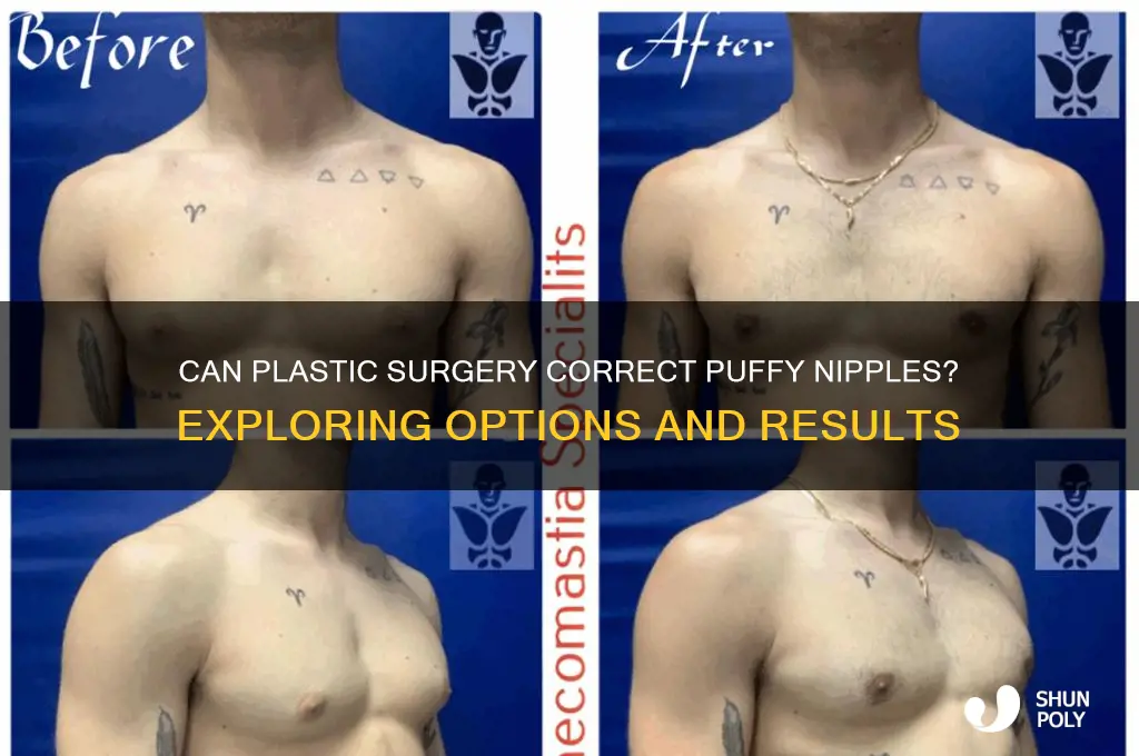can plastic surgery fix puffy nipples