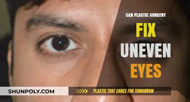 Can Plastic Surgery Correct Uneven Eyes? Exploring Options and Outcomes