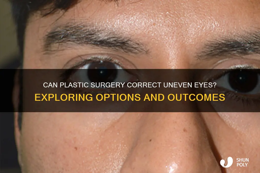 can plastic surgery fix uneven eyes