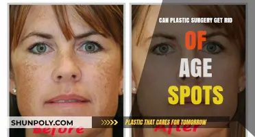 Can Plastic Surgery Effectively Remove Age Spots? Expert Insights
