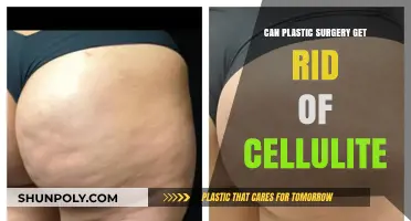 Can Plastic Surgery Effectively Eliminate Cellulite? Expert Insights Revealed