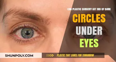 Can Plastic Surgery Eliminate Dark Circles Under Your Eyes?