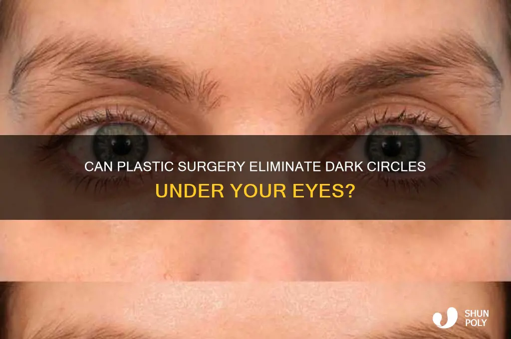 can plastic surgery get rid of dark circles under eyes
