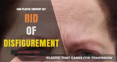 Plastic Surgery for Disfigurement: Can It Restore Confidence and Appearance?