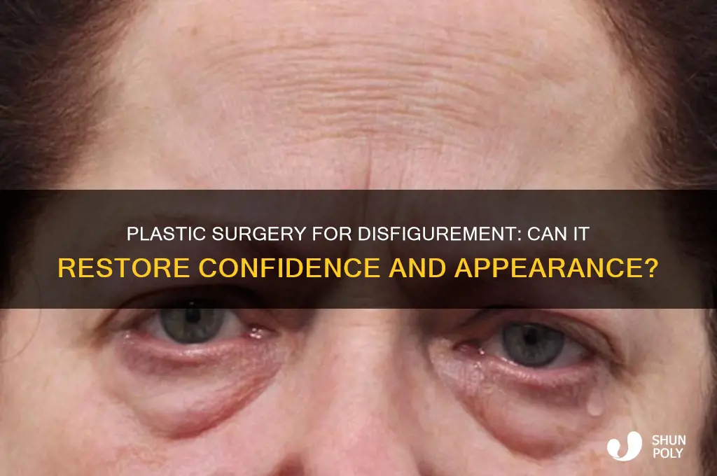 can plastic surgery get rid of disfigurement