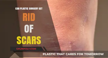 Can Plastic Surgery Effectively Remove Scars? Exploring Options and Outcomes