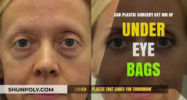 Can Plastic Surgery Effectively Eliminate Under Eye Bags?