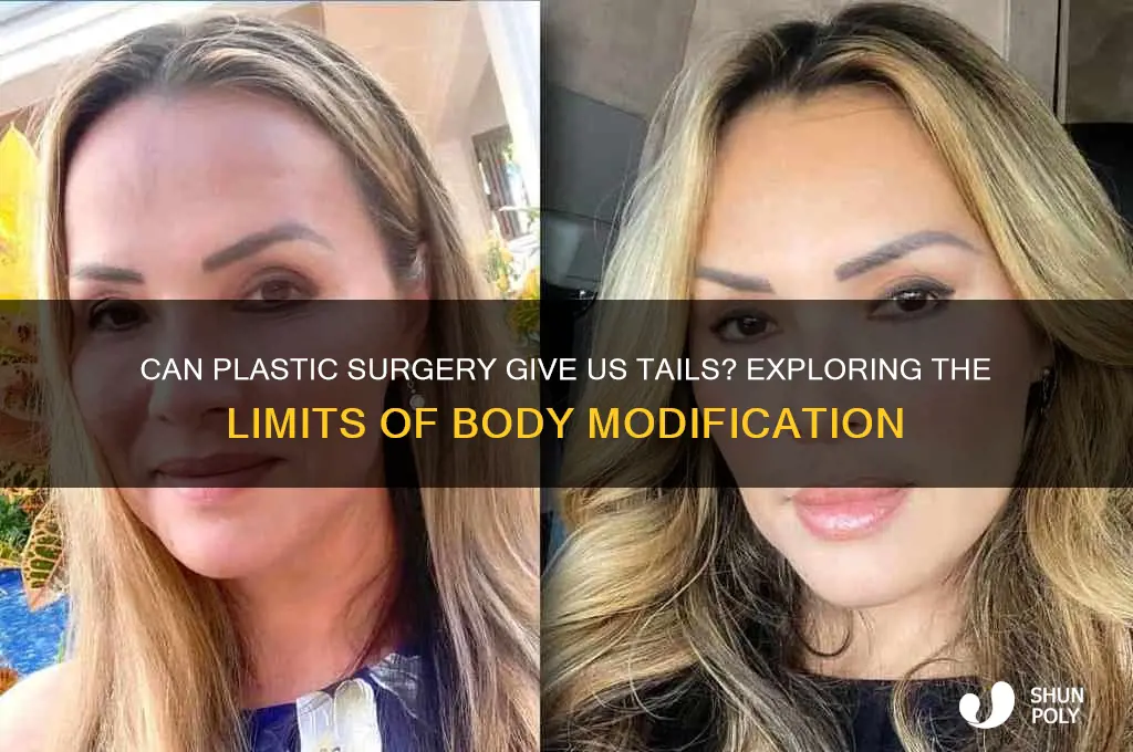 can plastic surgery give us tails