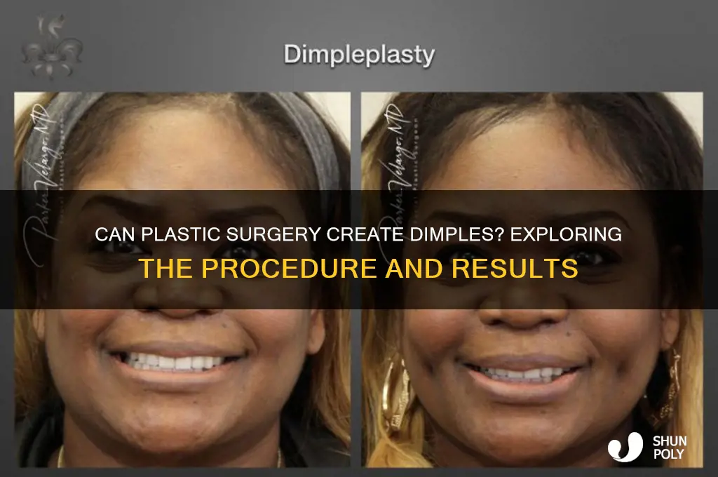 can plastic surgery give you dimples