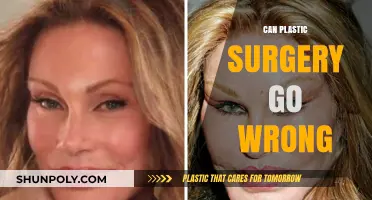 Plastic Surgery Risks: When Aesthetic Dreams Turn into Nightmares