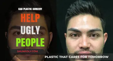 Can Plastic Surgery Transform Self-Perceived Ugliness into Confidence?