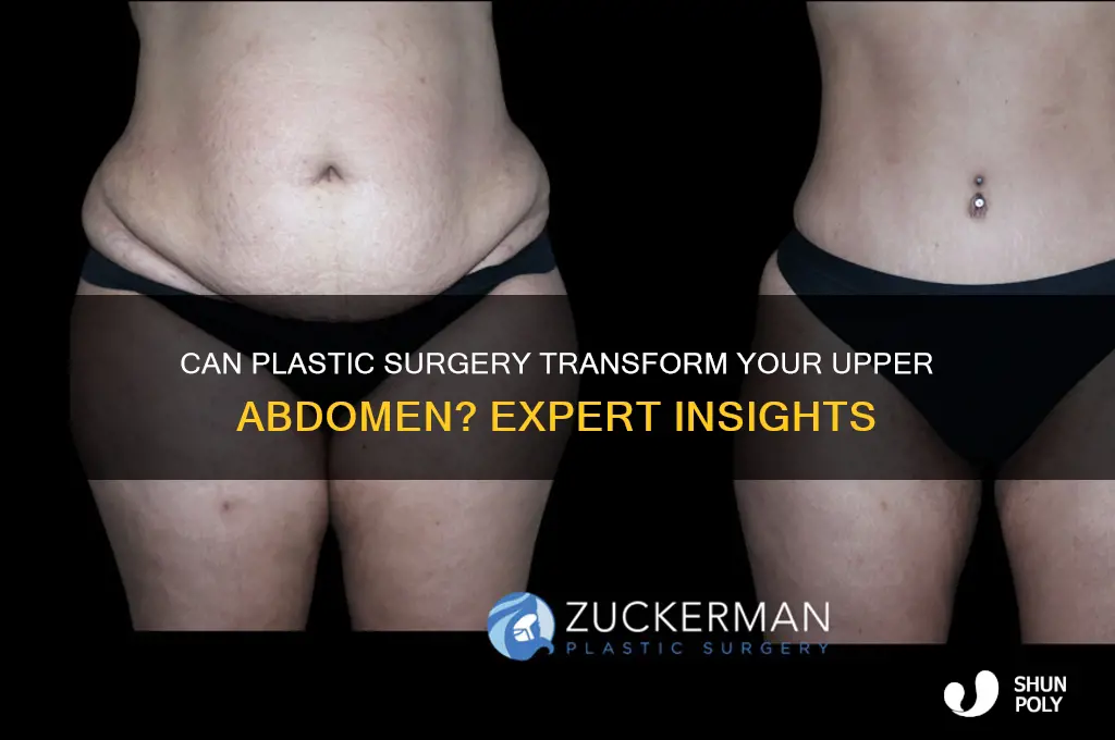 can plastic surgery help upper abdomen
