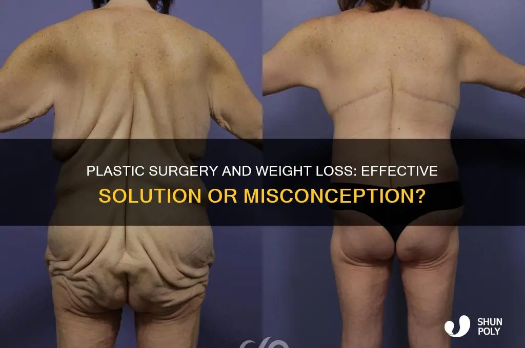 can plastic surgery help weight loss