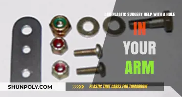 Can Plastic Surgery Repair a Hole in Your Arm?
