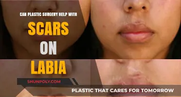 Labial Scar Revision: Can Plastic Surgery Improve Appearance and Confidence?