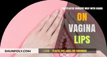 Vaginal Scar Revision: Can Plastic Surgery Improve Labial Appearance?