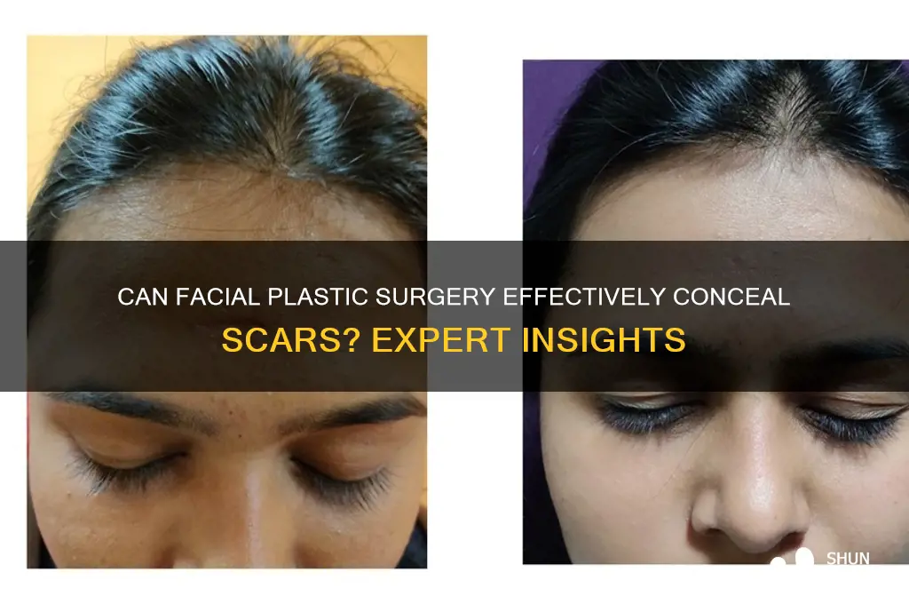can plastic surgery hide scars on face