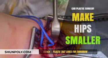 Can Plastic Surgery Reduce Hip Size? Exploring Options and Limitations