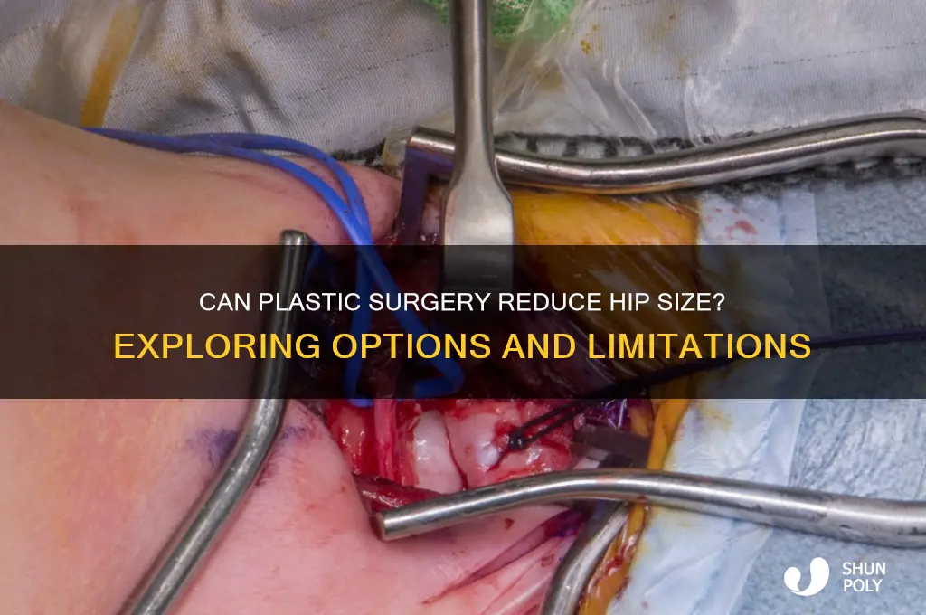 can plastic surgery make hips smaller