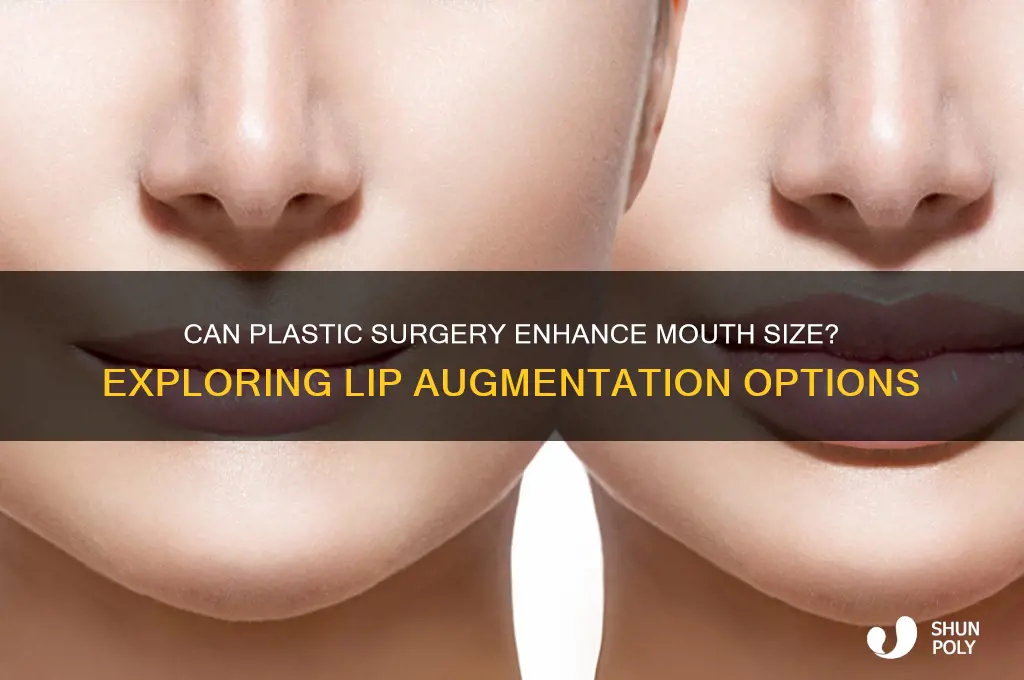 can plastic surgery make mouth larger
