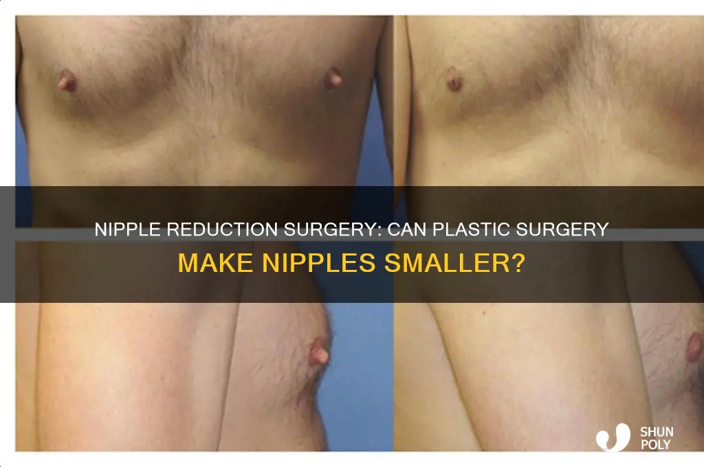 can plastic surgery make my nipples smaller