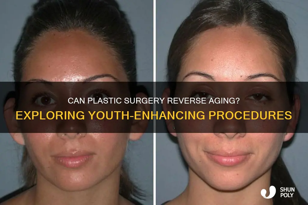 can plastic surgery make you younger