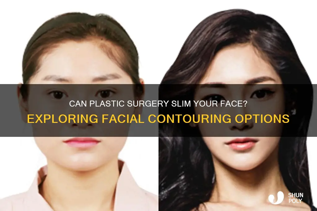 can plastic surgery make your face thinner