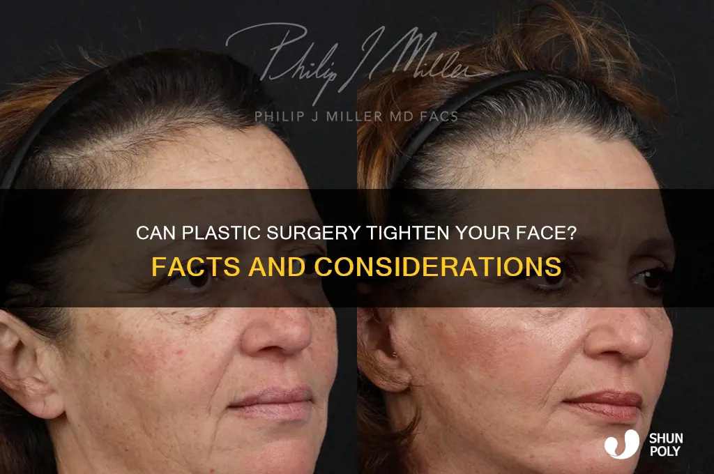 can plastic surgery make your face tighter