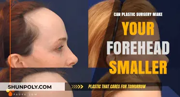 Can Plastic Surgery Reduce Forehead Size? Exploring Options and Results