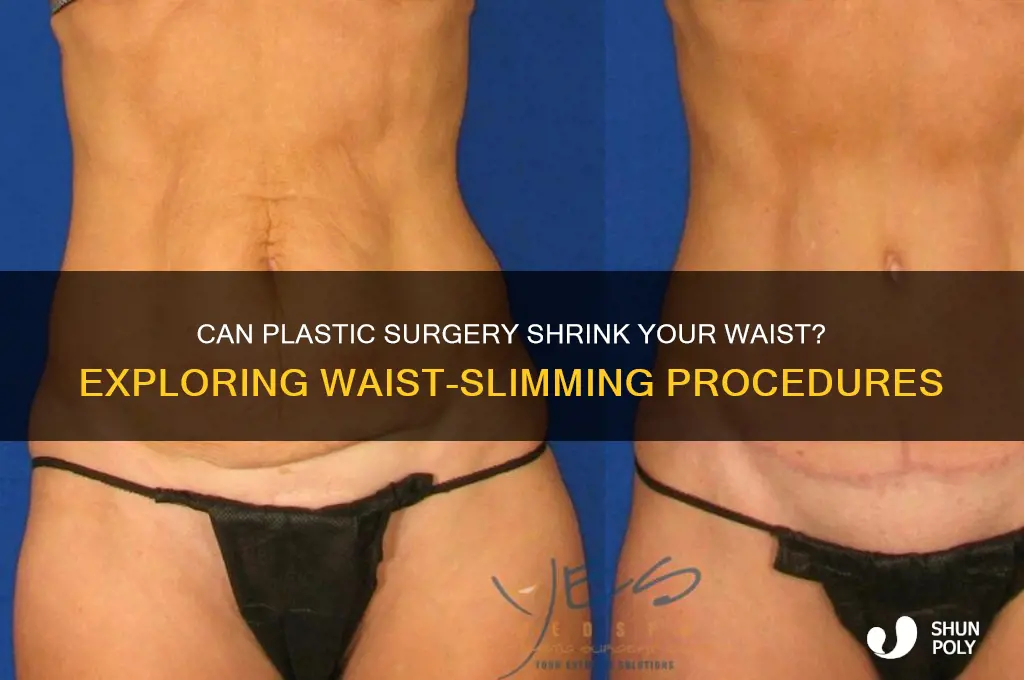 can plastic surgery make your waist smaller